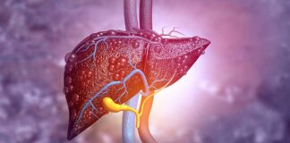 28 DE JULIO DIA MUNDIAL DE LA HEPATITIS