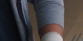 EMPLEDADO MUNICIPAL DENUNCIÓ UNA BRUTAL GOLPIZA DE UN COMPAÑERO EN PLENA JORNADA DE TRABAJO