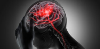 “EL ACV NO AVISA: SIEMPRE OCURRE DE FORMA BRUSCA”, ADVIERTE LA NEURÓLOGA ANDREA MARENGO